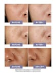 Kiehls Clearly Corrective Dark Spot Solution product photo View 09 S