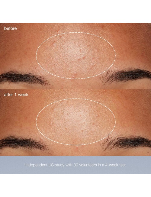 Dermalogica Daily Microfoliant 74g product photo View 06 L