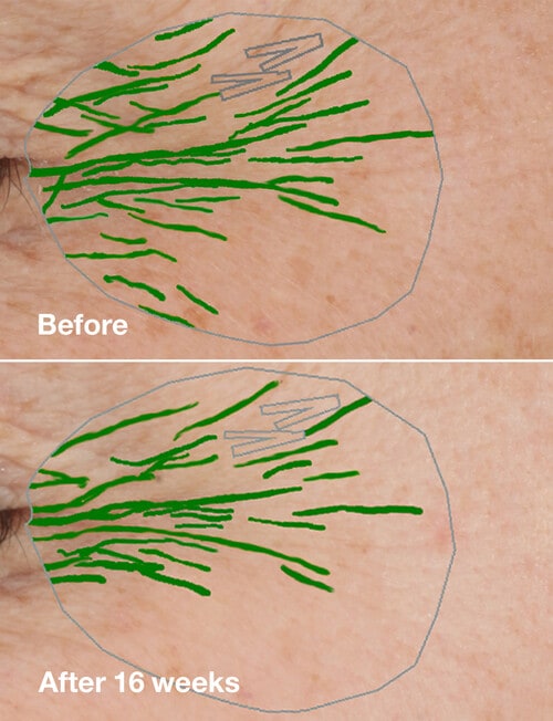 Clinique Smart Clinical Repair Wrinkle Correcting Serum, 30ml product photo View 05 L