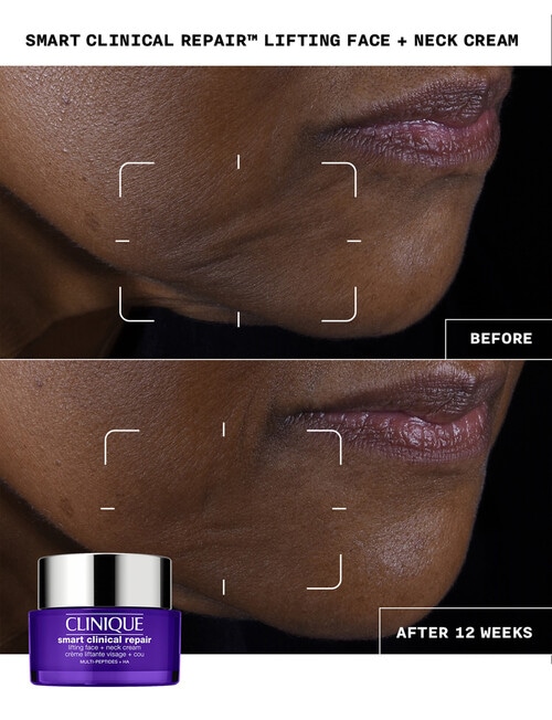 Clinique Smart Clinical Repair Lifting Face + Neck Cream, 50ml product photo View 03 L