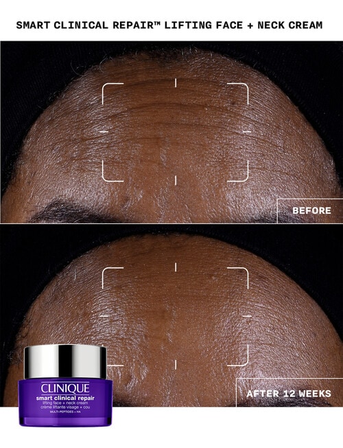 Clinique Smart Clinical Repair Lifting Face + Neck Cream, 50ml product photo View 04 L