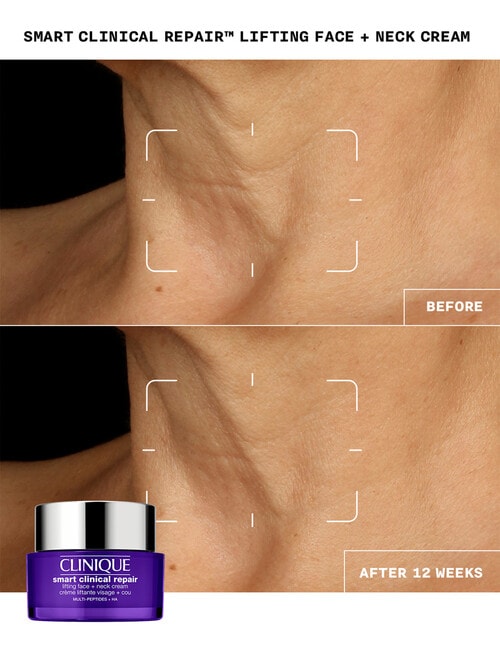Clinique Smart Clinical Repair Lifting Face + Neck Cream, 50ml product photo View 05 L