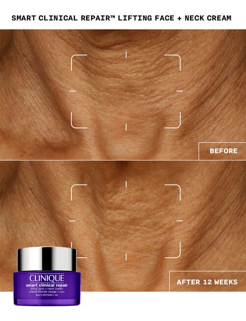 Clinique Smart Clinical Repair Lifting Face + Neck Cream, 50ml product photo View 06 L
