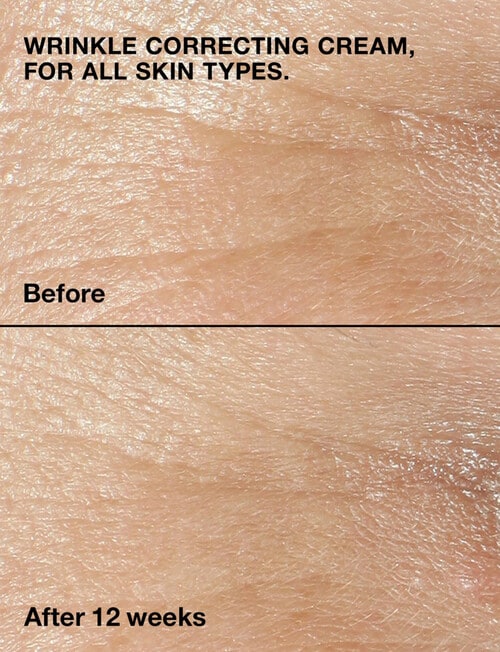 Clinique Smart Clinical Wrinkle Correcting Cream, 75ml product photo View 03 L