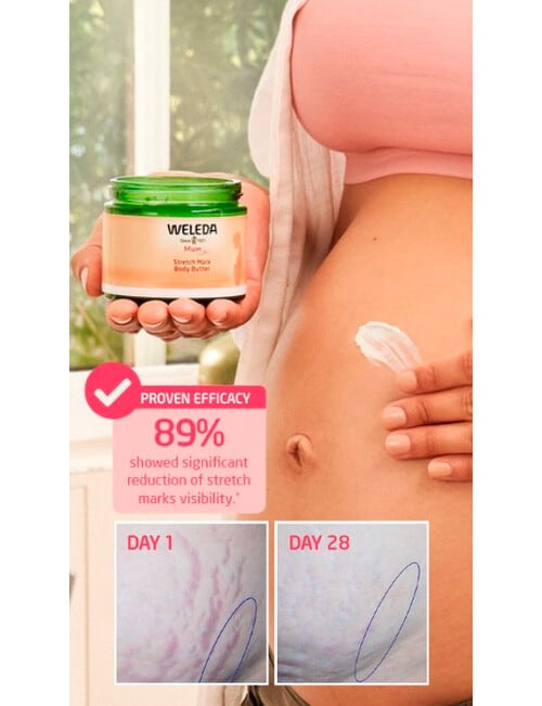 Weleda Stretch Mark Body Butter, 150ml product photo View 04 L