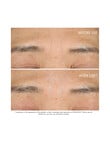 Dior Capture Totale Hyalushot Wrinkle Corrector product photo View 03 S