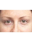 Clinique All About Eyes Brightening Serum Concentrate, 10ml product photo View 07 S
