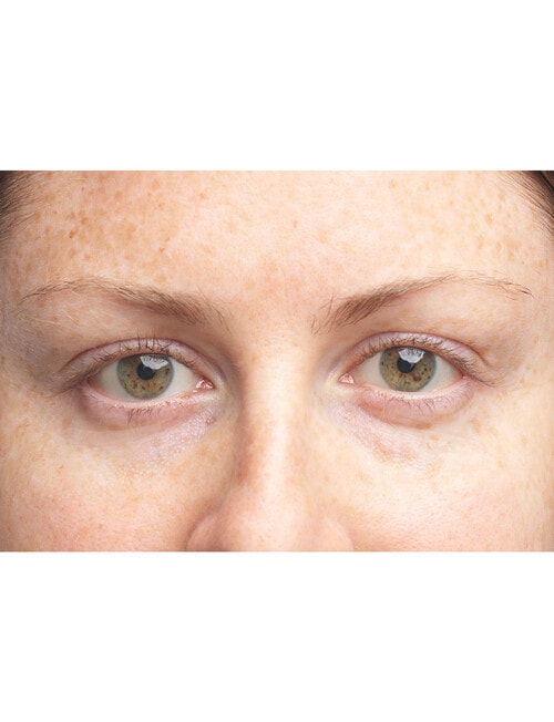 Clinique All About Eyes Brightening Serum Concentrate, 10ml product photo View 07 L