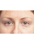 Clinique All About Eyes Brightening Serum Concentrate, 10ml product photo View 08 S