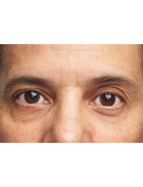 Clinique All About Eyes Brightening Serum Concentrate, 10ml product photo View 09 L