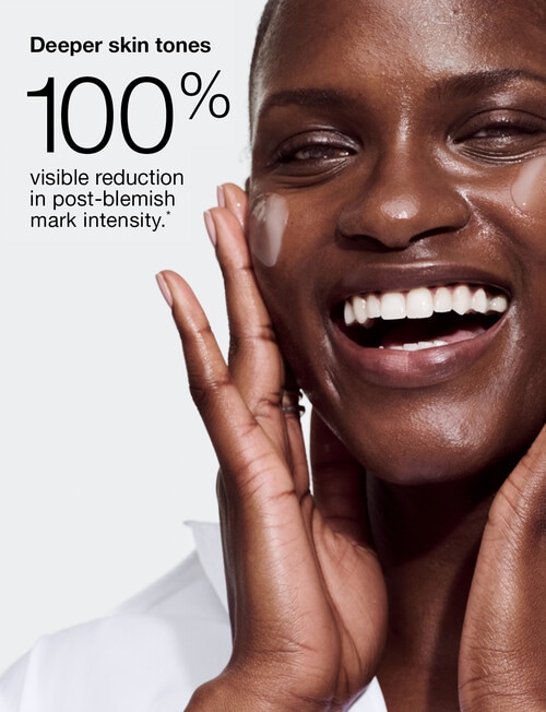 Clinique Even Better Clinical Dark Spot Clearing Serum, 30ml product photo View 14 L