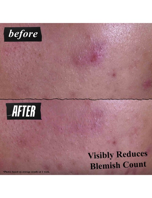 Kiehls Gently Effective Blemish-Targeting Cleansing Paste product photo View 05 L