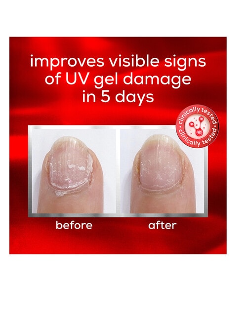 essie Care To The Rescue Advanced Nail Treatment product photo View 05 L