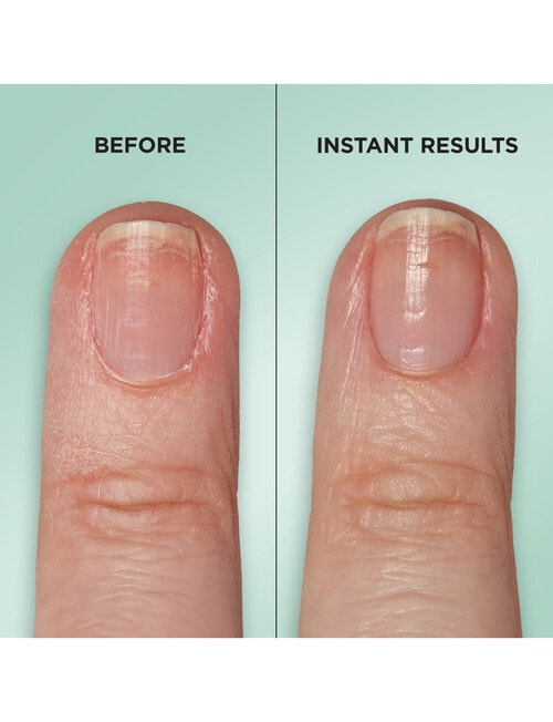 Sally Hansen Gel Rehab Nail Repair Serum product photo View 05 L