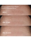 Clinique Anti-Aging Routine: Mini Smart Clinical Repair Kit product photo View 05 S