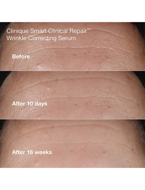 Clinique Anti-Aging Routine: Mini Smart Clinical Repair Kit product photo View 05 L