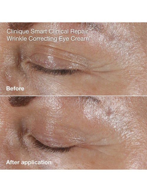 Clinique Anti-Aging Routine: Mini Smart Clinical Repair Kit product photo View 06 L
