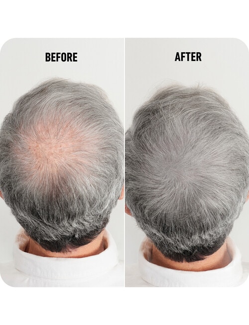 BOLDIFY. Hair Thickening Fibers Dark Grey, 28g product photo View 04 L