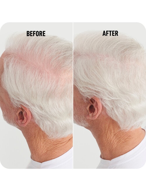 BOLDIFY. Hair Thickening Fibers White, 28g product photo View 04 L